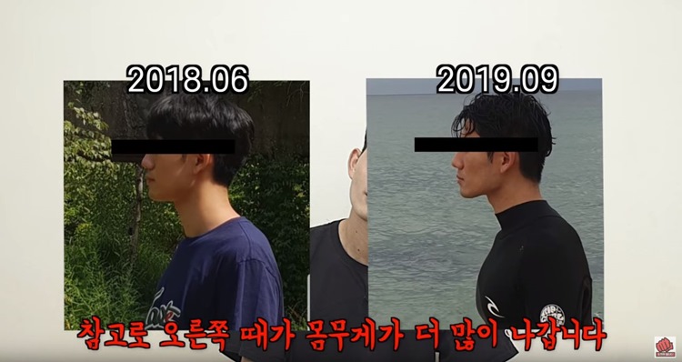 '혓바닥 운동' 한 남자 유튜버가 날렵하게 바뀐 얼굴형을 공개했다